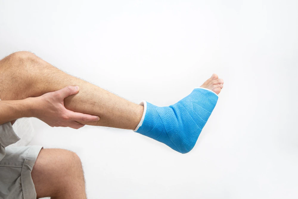 Ankle Fracture: Post Fracture Rehab